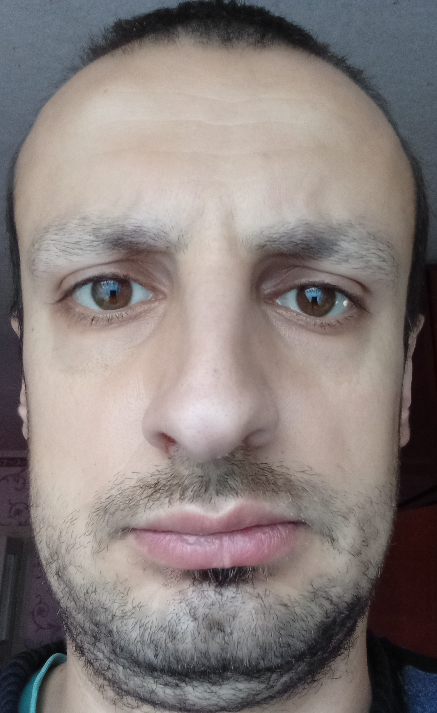 Диагностика по фото - IMG_20250924_095837 (1).jpg